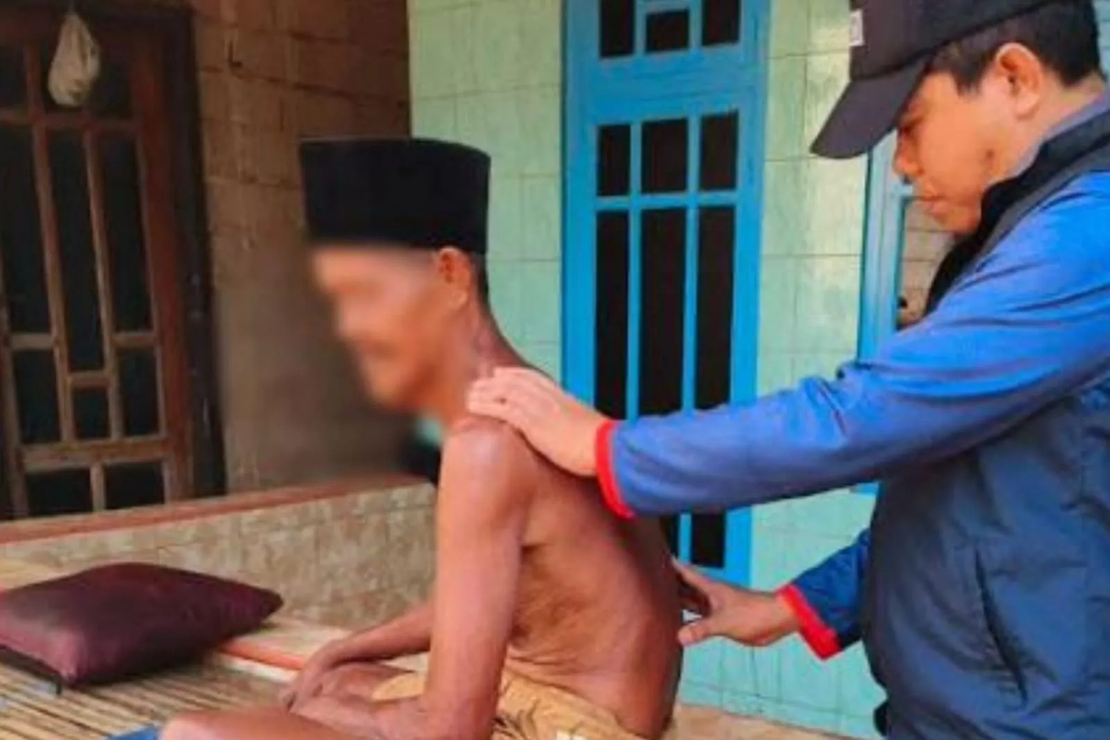 Cegah Penularan Kusta, Dinkes P2KB Sumenep Sisir Pulau di Sumenep (Ilustrasi)